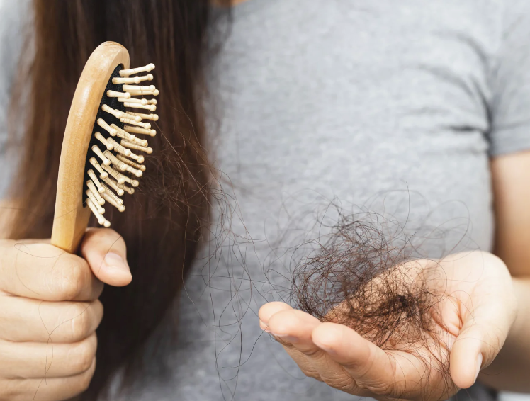 Kadınlarda Saç Dökülmesi ve Tedavisi