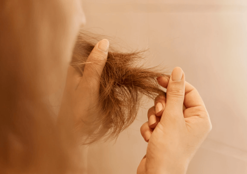 Saç Yolma Hastalığı (Trikotillomani)